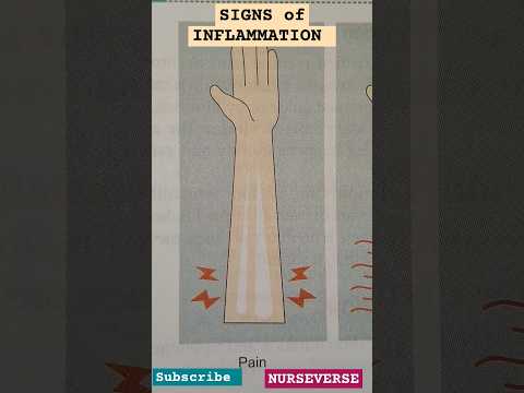 5 Signs of INFLAMMATION||Cardinal signs|#signs#cardinal#classical#inflammation#notes#shorts#ytshorts